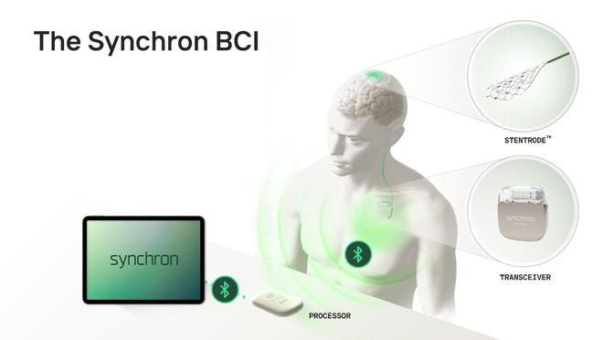 苹果合作开发脑机接口设备VisionPro可用意念操控(图5)